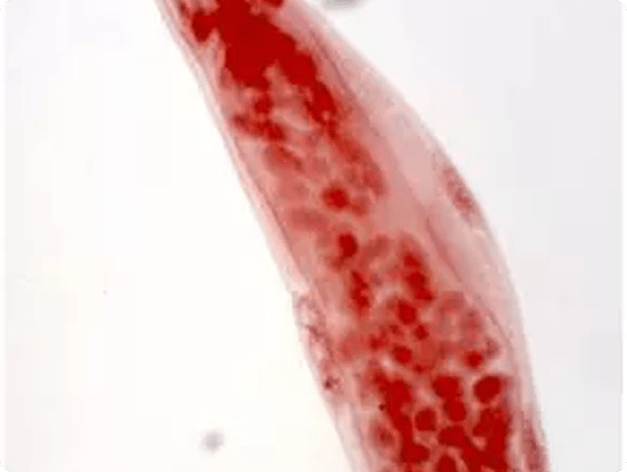 Female Neoechinorhynchus sp