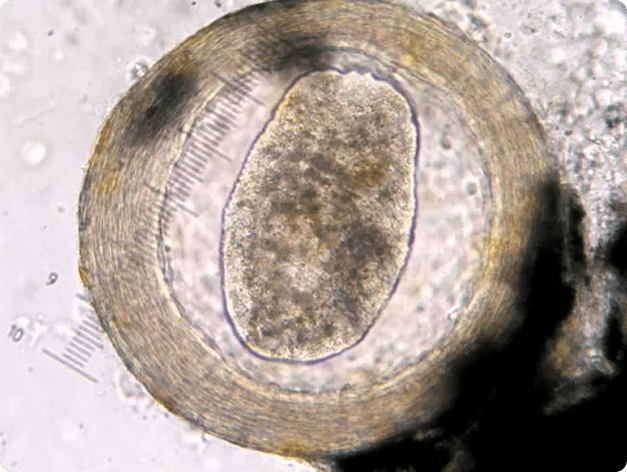 Immature Neascus