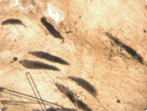 Myxobolus insidiosus Cysts in Muscle