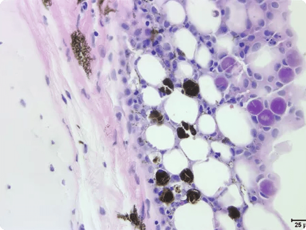 White Sturgeon Tissue Infected with Virus